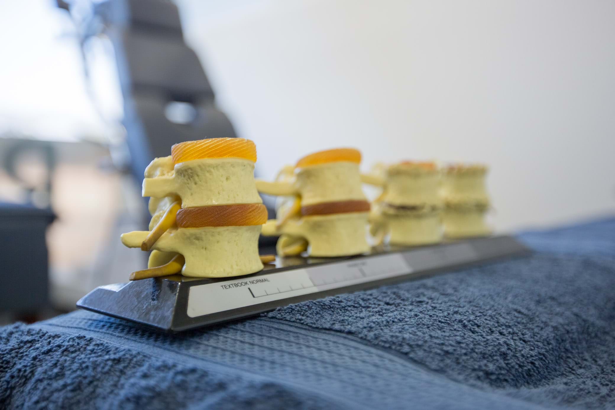 degeneration arthritis osteoporosis